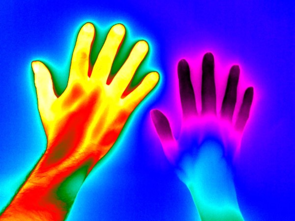 Raynaud's Phenomenon.