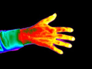 view Thermogram of normal hand