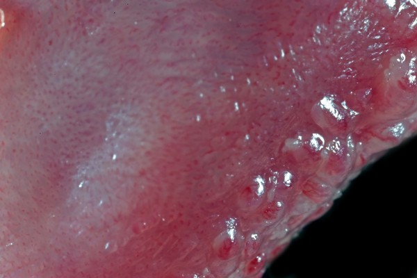 Bottom surface of a human tongue