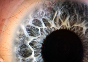 view Human eye with blue iris