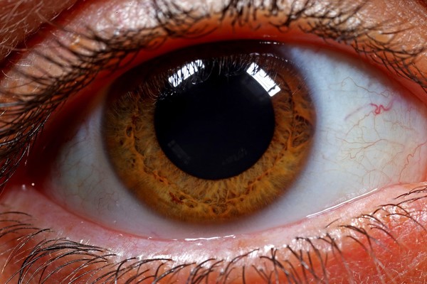 Human eye