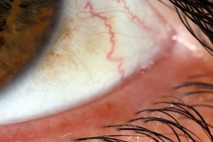 view Sclera (white part) of the human eye