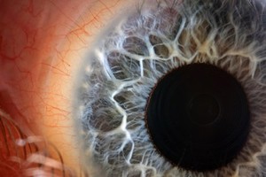 view Human eye with blue iris