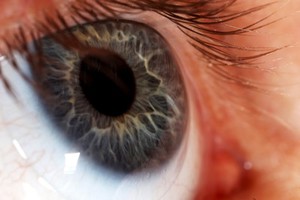 view Human eye with blue iris