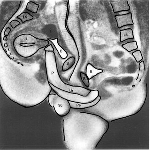 view Magnetic resonance imaging MRI showing sexual intercourse