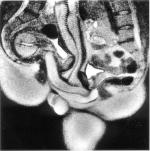 view Magnetic resonance imaging MRI showing sexual intercourse