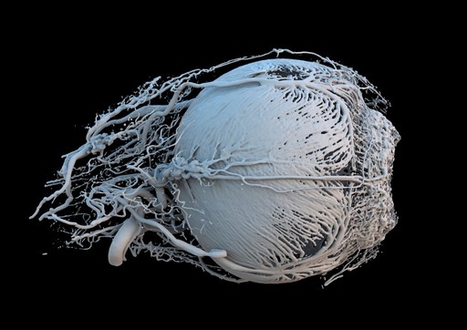 3D print of vessels of a healthy minipig eye