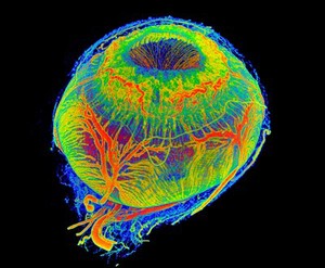 view 3D view on vessels of a healthy minipig eye. The upper opening corresponds to the pupil as the gateway input of all light into the eye. It is interesting to see the marked abundance of vessels of the pupil which bring energy and food to the muscles to control the amount of incident light. The other large vessels are feeder vessels for the outer layers of the retina and muscles, so, that the eye quickly can perceive the environment and the creature may adapt and survive.