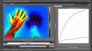 view Raynaud's Phenomenon