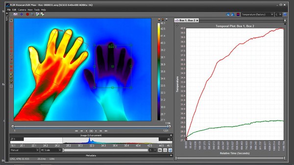 Raynaud's Phenomenon