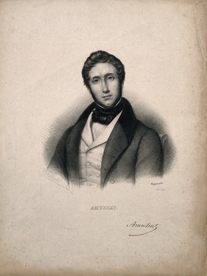 view Jean Zuléma Amussat. Lithograph by Z. Belliard after J.G.E. Naigeon.