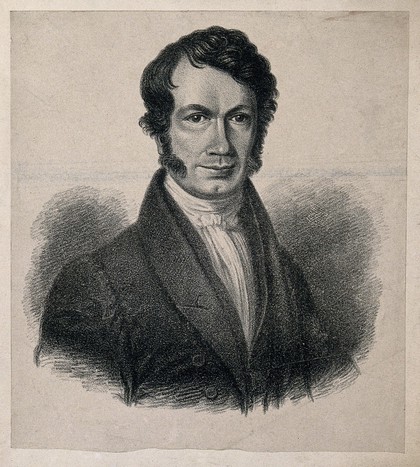William Beaumont (?). Lithograph.