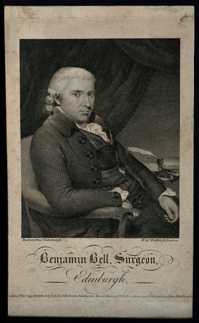 Benjamin Bell. Line engraving by W. Walker and J. Walker, 1791, after H. Raeburn.