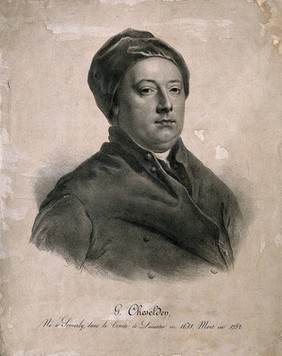 William Cheselden. Lithograph.