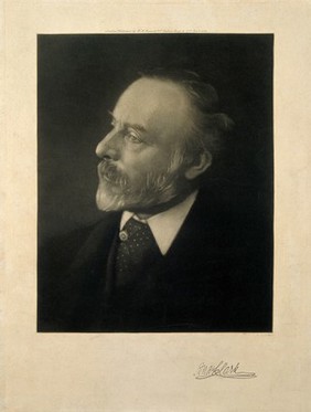 Sir Andrew Clark. Photogravure, 1888.