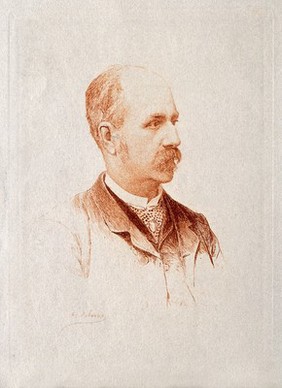 André Victor Cornil. Etching by A. Lalauze.