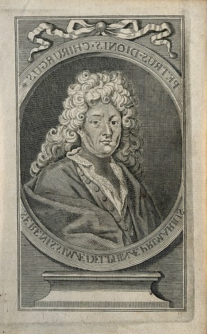 view Pierre Dionis. Engraving.