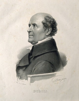 Antoine Dubois, Baron Dubois (1756-1837). Lithograph by Charles-Louis Bazin after François-Pascal-Simon Gérard, Baron Gérard, 1803.