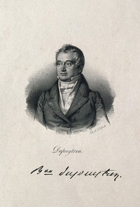 Guillaume, Baron Dupuytren. Lithograph.