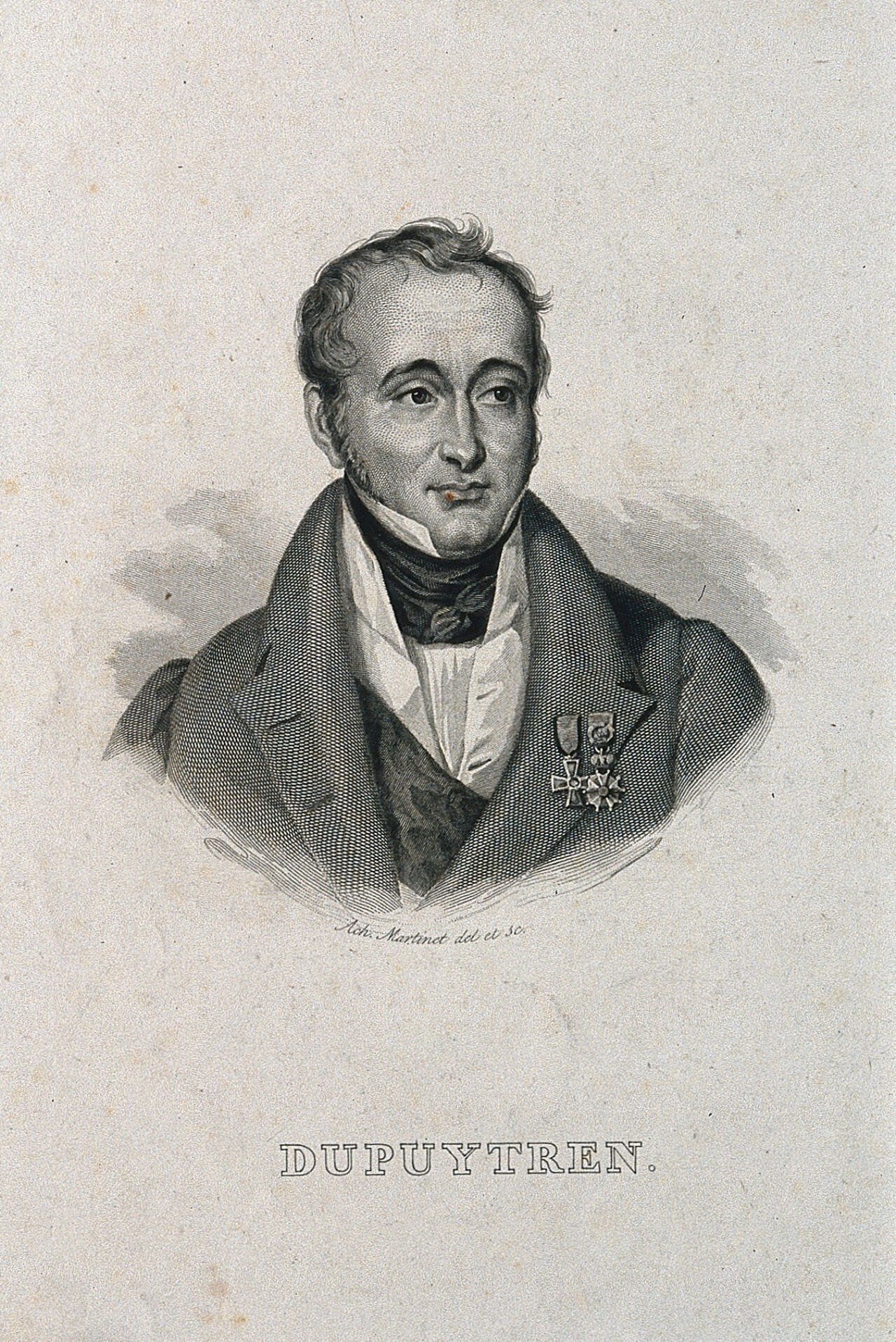 Guillaume, Baron Dupuytren. Line engraving by A. Martinet after himself., by Achille-Louis Martinet