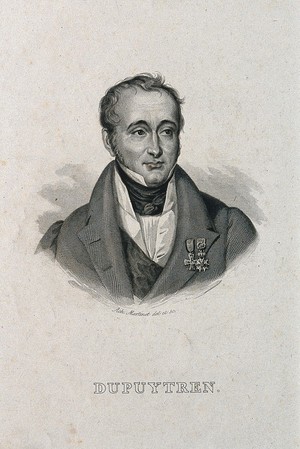 view Guillaume, Baron Dupuytren. Line engraving by A. Martinet after himself.