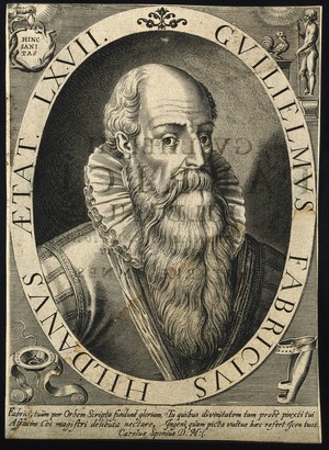 view Guglielmus Fabricius of Hilden. Line engraving.