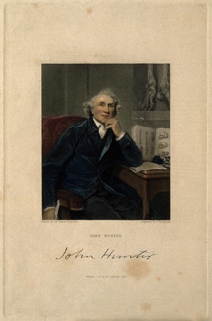 view John Hunter. Stipple engraving by G. H. Adcock, 1833, after Sir J. Reynolds, 1786.