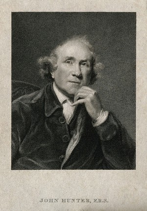 view John Hunter. Stipple engraving by T. Wright after Sir J. Reynolds, 1786.