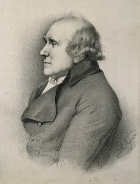 John Hunter. Lithograph by T. H. Maguire, 1849, after Sir N. Dance-Holland, 1793.