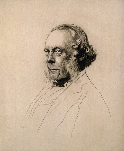 Joseph Lister, 1st Baron Lister. Etching by A. W. Turnbull after R. A. Bickersteth.