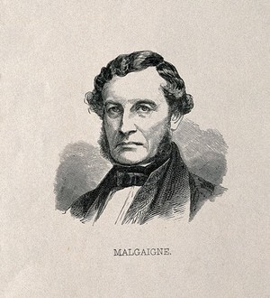view Joseph-François Malgaigne. Wood engraving.