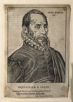 view Ambroise Paré. Woodcut, 1582.