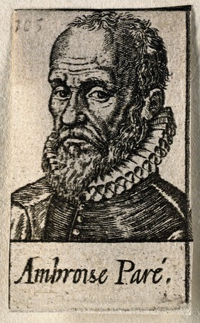 Ambroise Paré. Line engraving.