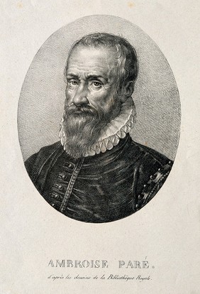 Ambroise Paré. Lithograph by Chrétien.