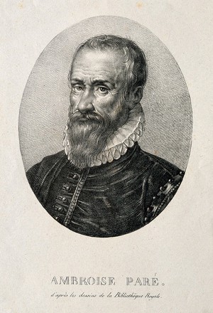 view Ambroise Paré. Lithograph by Chrétien.