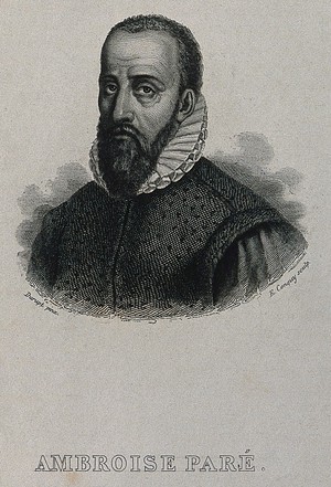 view Ambroise Paré. Line engraving by E. Conquy after Durupt.