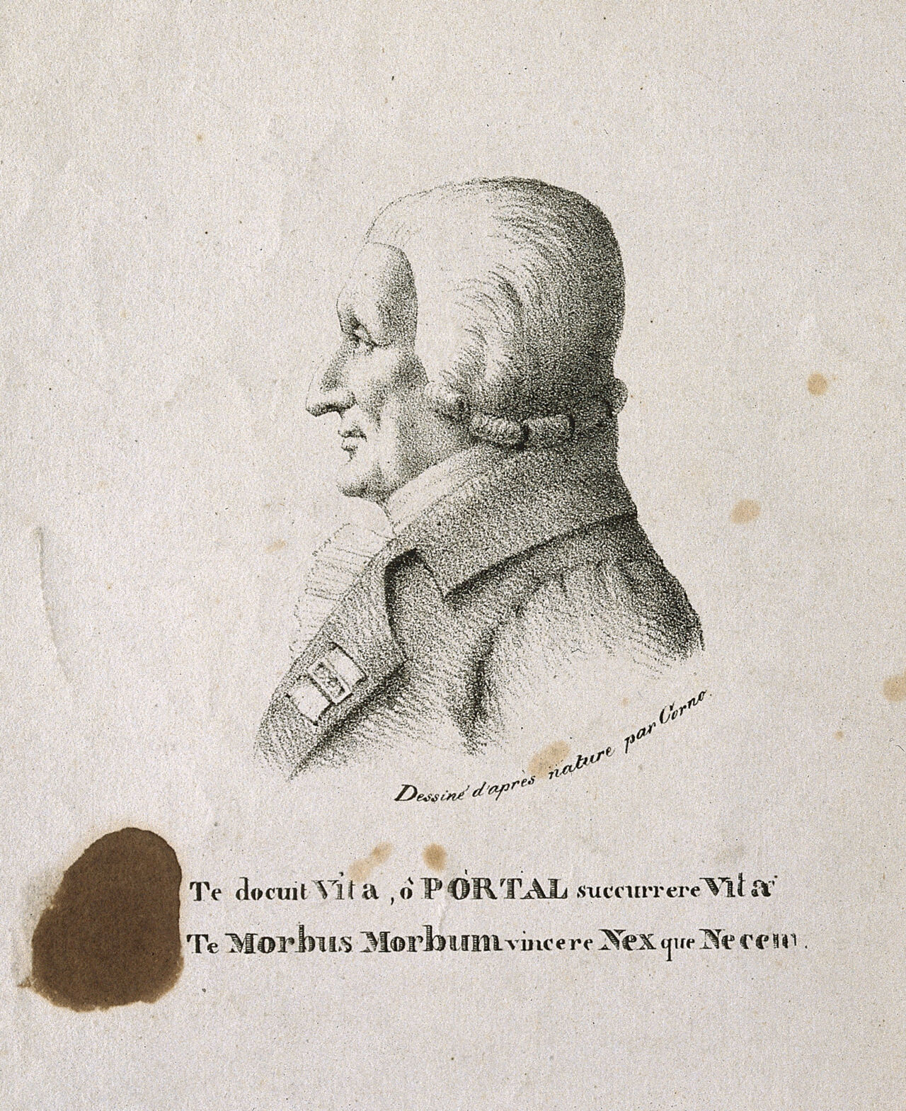 Antoine, Baron Portal. Lithograph by Corno after himself., by Corno
