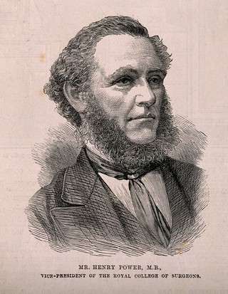 Henry Power. Wood engraving.