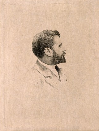Samuel Pozzi. Etching.