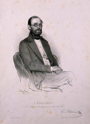 view Karl, Freiherr von Rokitansky. Lithograph by E. Kaiser, 1850.
