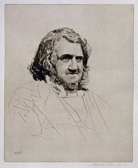 Sir James Young Simpson. Etching by A. W. Turnbull after J. Moffat.