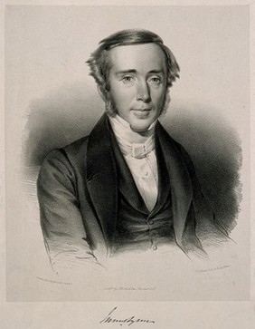 James Syme. Lithograph by W. Stewart, 1845, after himself.