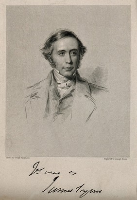 James Syme. Stipple engraving by J. Brown after G. Richmond.