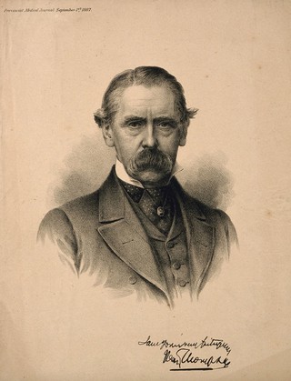 Sir Henry Thompson. Lithograph, 1887, after J. E. Millais.