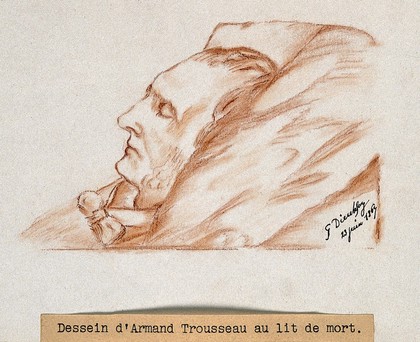 Armand Trousseau on his deathbed. Red chalk drawing by G. Dieulafoy, 1867.