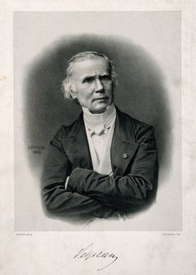 Alfred Armand Louis Marie Velpeau. Lithograph by J.B.A. Lafosse, 1865, after P. Petit.
