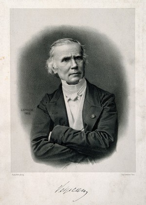 view Alfred Armand Louis Marie Velpeau. Lithograph by J.B.A. Lafosse, 1865, after P. Petit.