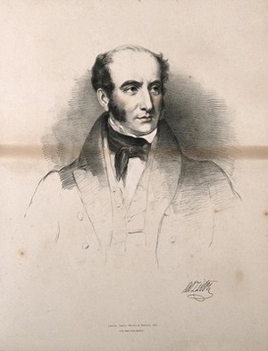 view Robert Liston. Lithograph by M. Gauci, 1836, after E. U. Eddis.