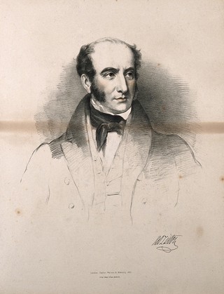 Robert Liston. Lithograph by M. Gauci, 1836, after E. U. Eddis.