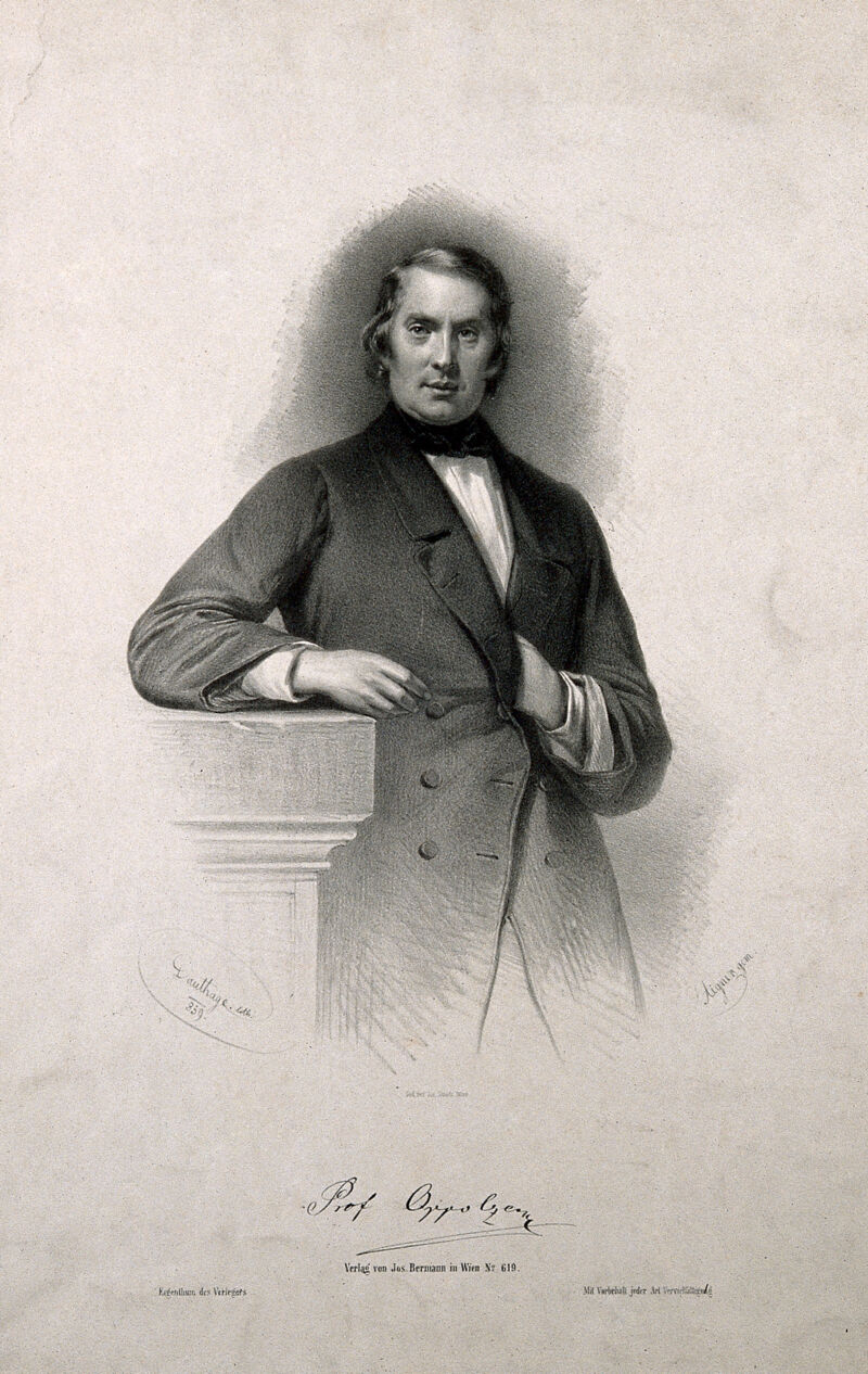 Johann, Ritter von Oppolzer. Lithograph by A. Dauthage, 1859, after J.M. Aigner., 1859, by Joseph Matthäus Aigner